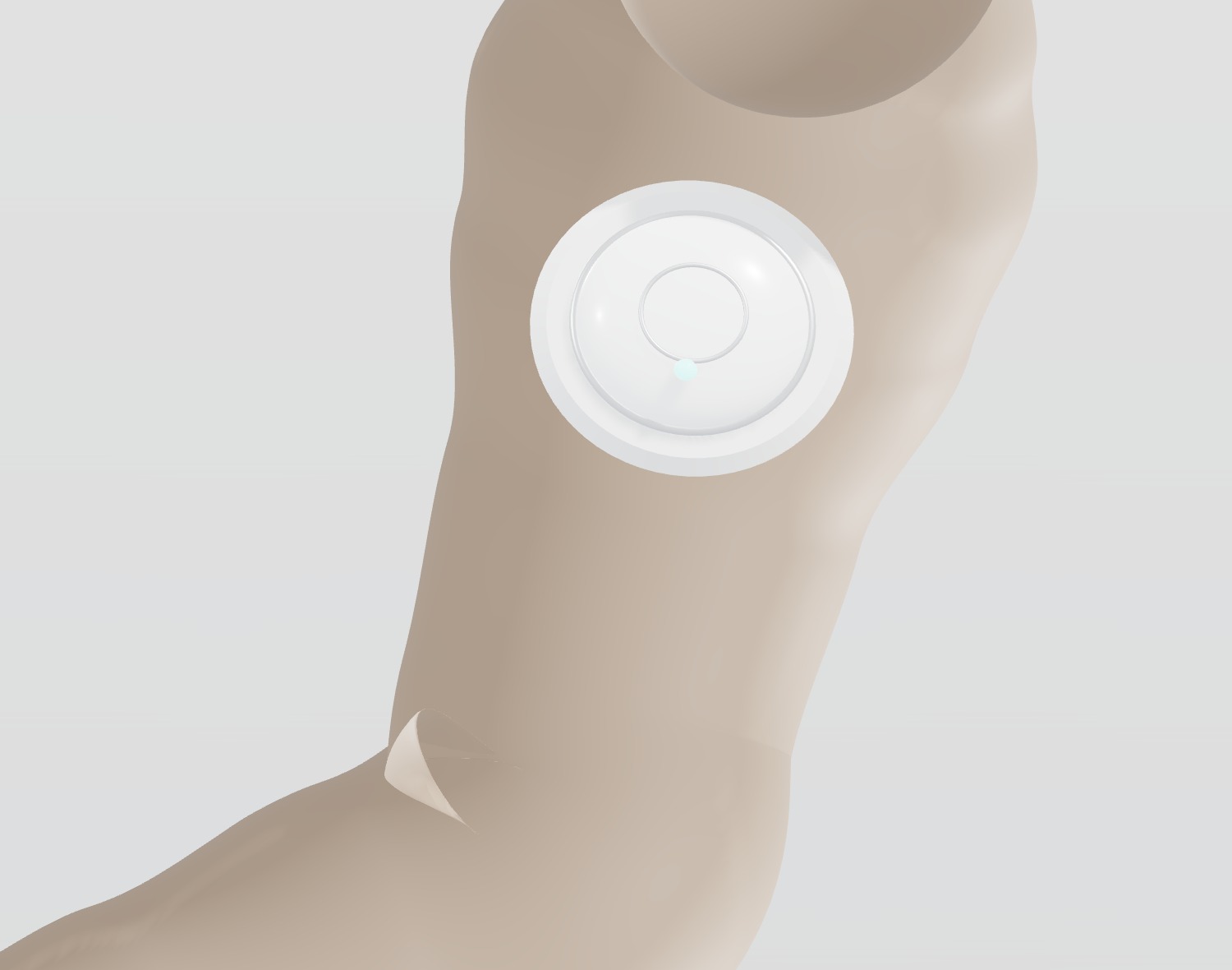 The 7-day pod worn on the back of the upper arm