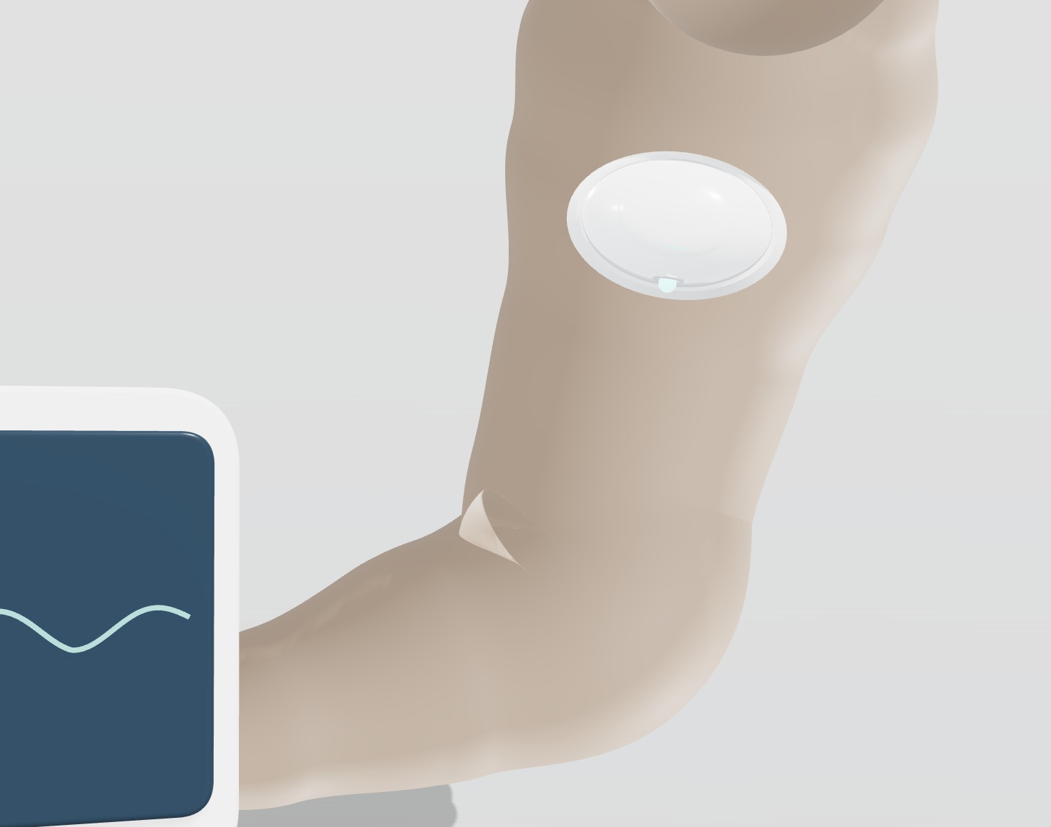 The long-term infusion pod worn on the arm with its paired wireless monitor